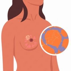 Best Cancer Specialist In Lucknow, best oncologist in lucknow, best cancer doctor in lucknow