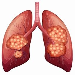 Best Cancer Specialist In Lucknow, best oncologist in lucknow, best cancer doctor in lucknow