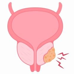 Best Cancer Specialist In Lucknow, best oncologist in lucknow, best cancer doctor in lucknow