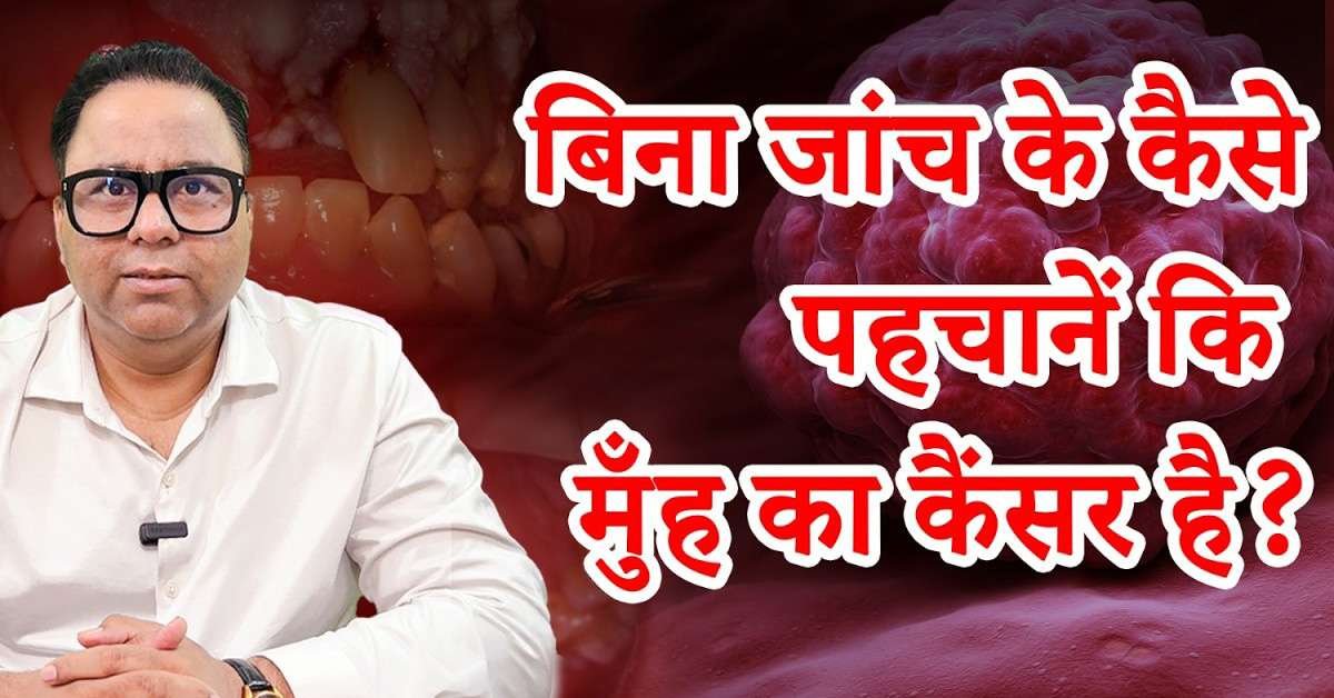Oral Cancer मुख का कैंसर | Dr Harsh Atreya | Best Oncologist In Lucknow