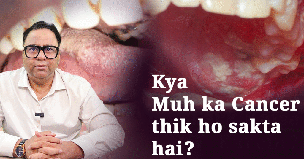 oral cancer doctor in lucknow - best cancer doctor in lucknow | Dr Harshvardhan Atreya 