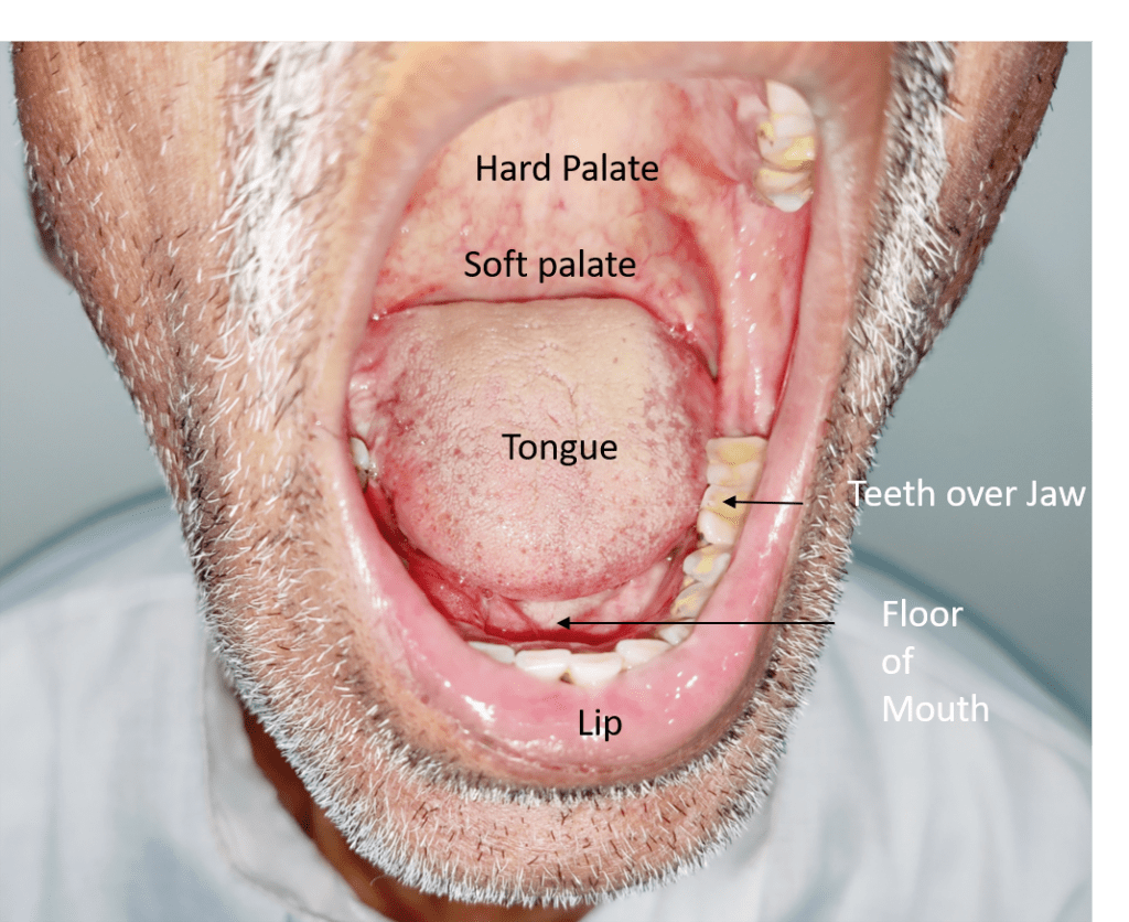 oral cancer doctor in lucknow - best cancer doctor in lucknow | Dr Harshvardhan Atreya 