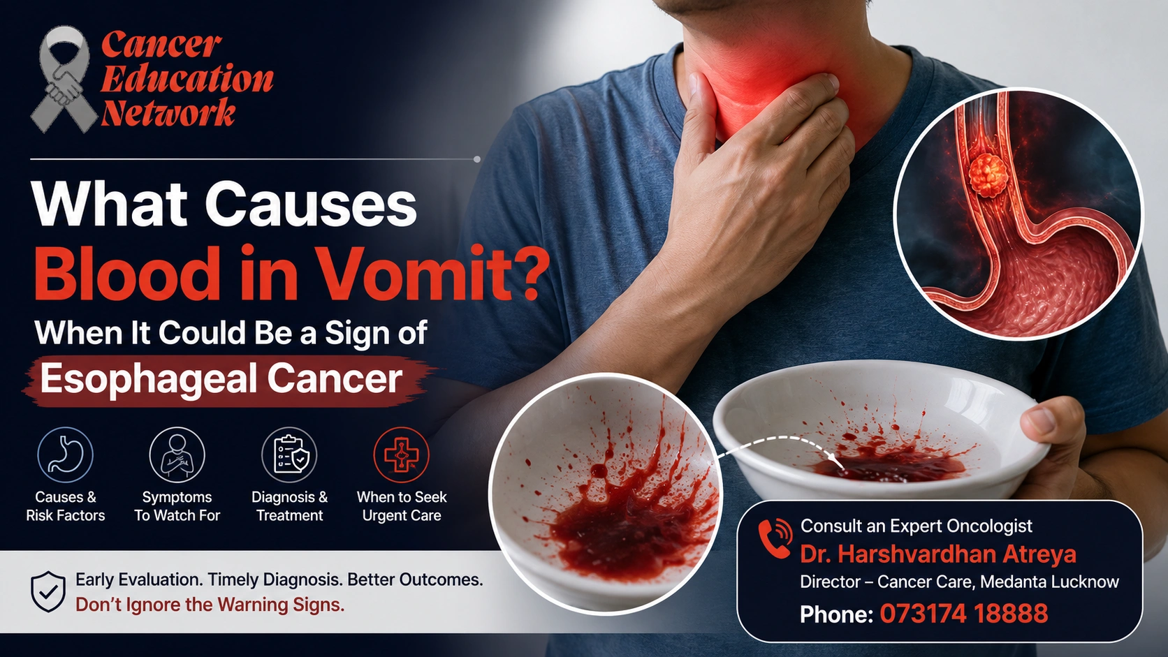 Blood in vomit can have several causes and may require urgent medical evaluation, especially when accompanied by symptoms of esophageal cancer