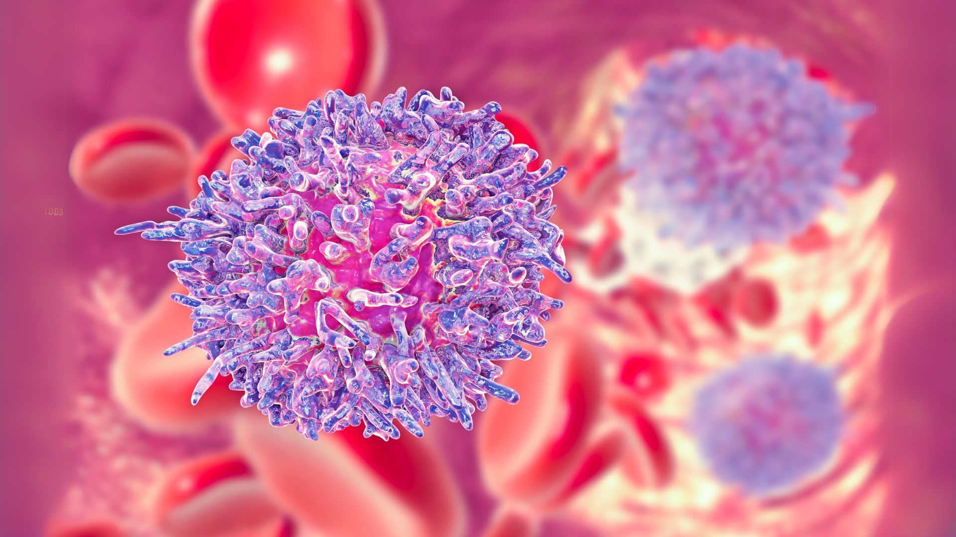Leukemia Warning Signs You Should Never Ignore