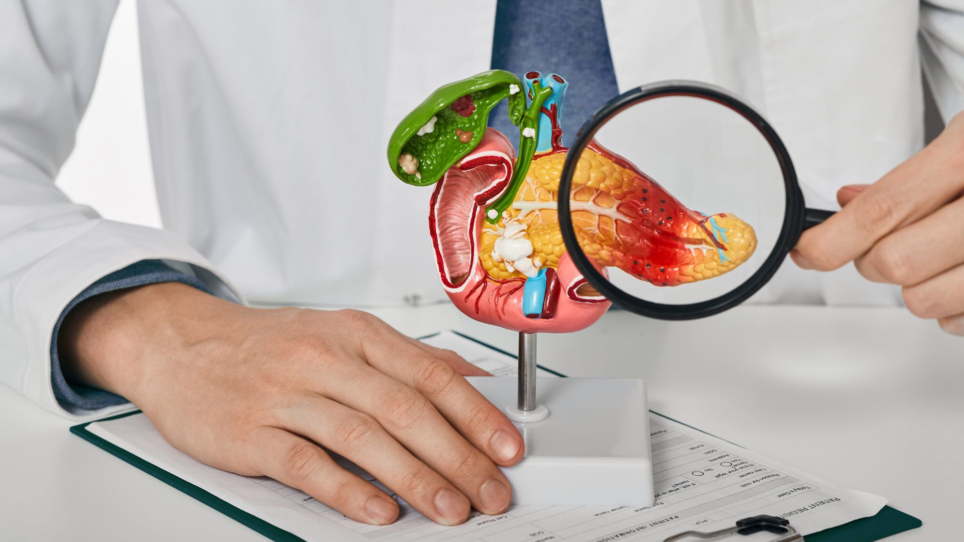 Pancreatic Cancer: Don’t Miss These Silent Signs