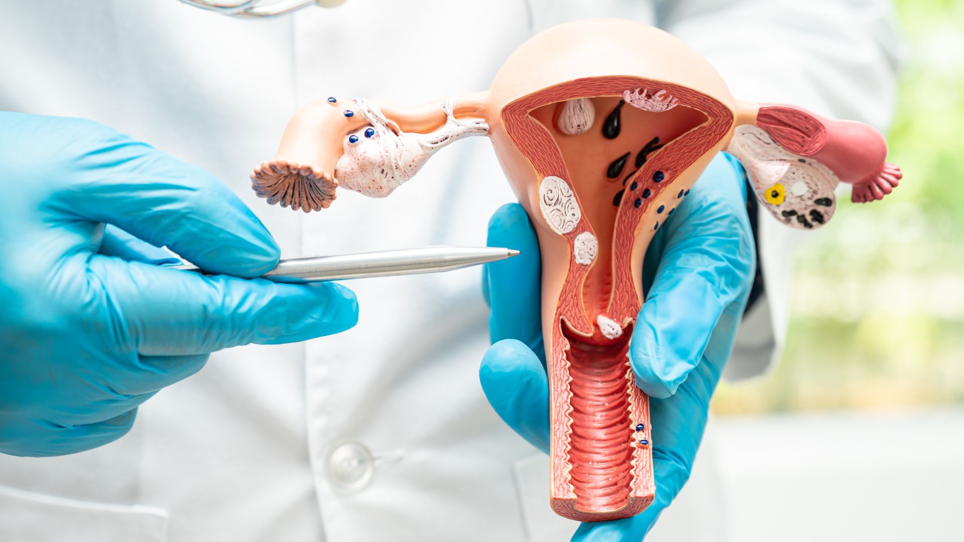 Cervical Cancer Warning: Signs You Should Never Ignore