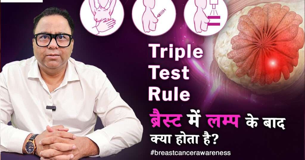 Breast Cancer Checkup after 40- best oncologist in Lucknow - Dr Harsh Atreya